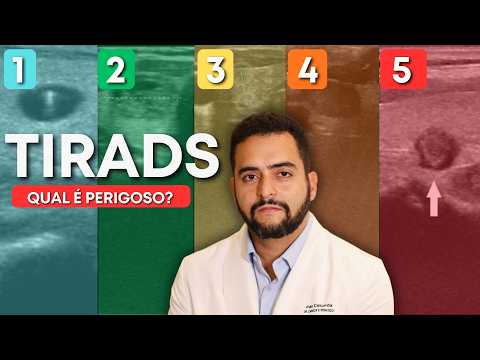 TIRADS 1 a 5: qual realmente indica risco de câncer? | Dr. Jônatas Catunda