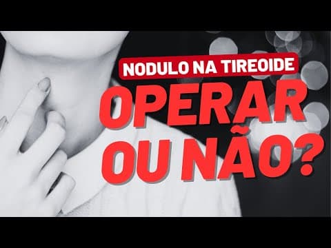 Nódulo benigno de 4 cm na tireoide: operar ou acompanhar?