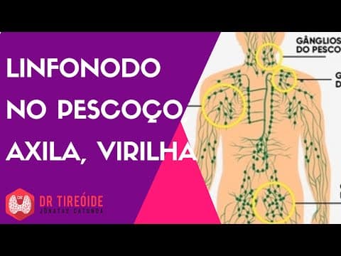 Linfonodo no pescoço, axila e virilha - Dr Jônatas Catunda