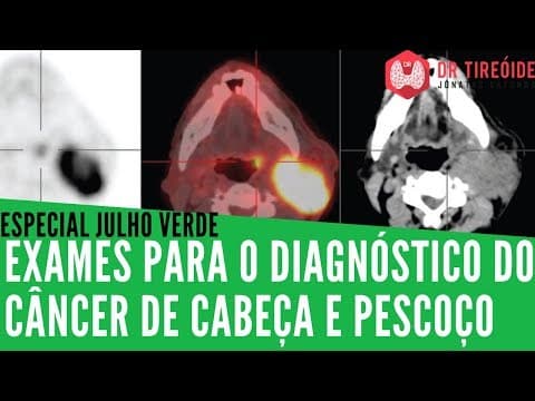 Julho Verde - Exames para o diagnóstico do Câncer de Cabeça e Pescoço
