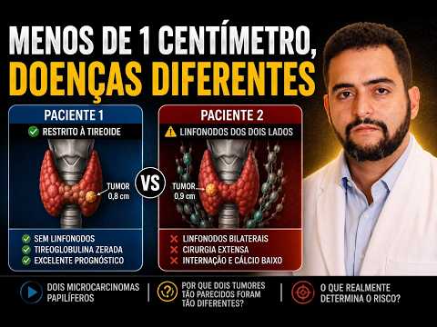 2 casos de câncer de tireoide menor que 1 cm — completamente diferentes