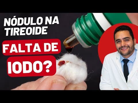 Nódulo na Tireoide: Será que a Deficiência de Iodo é a Causa?
