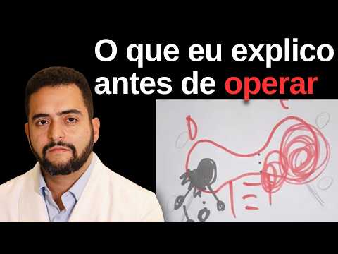 Riscos da cirurgia da tireoide: como eu explico isso aos meus pacientes | Dr. Jônatas Catunda