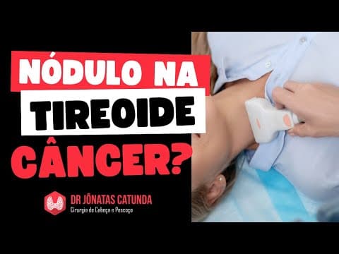 Nódulo na tireoide - como saber se é câncer?