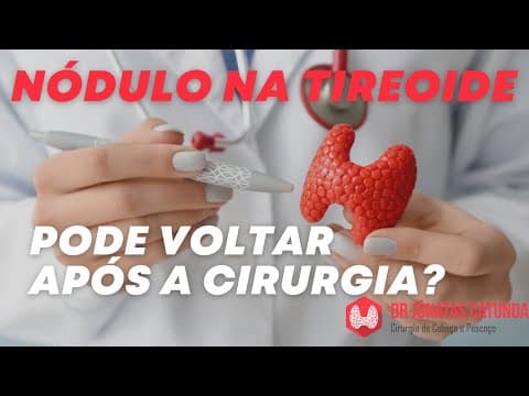 Nódulo na tireoide pode voltar após a tireoidectomia total?