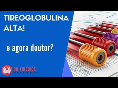 Tireoglobulina alta! E agora doutor? - Dr Tireóide responde