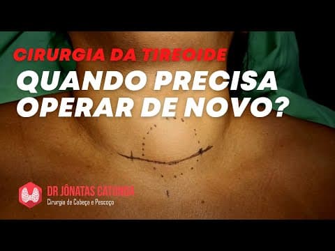 Tireoidectomia - é possível ter que operar de novo?