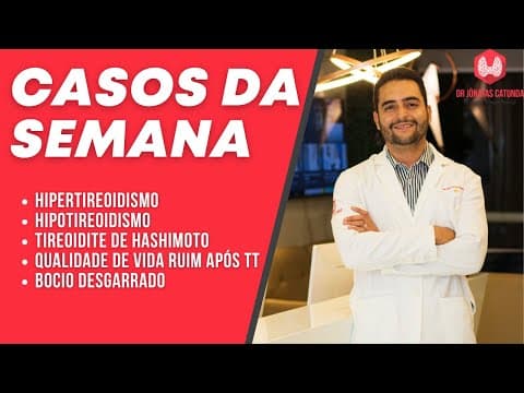 Casos da semana - Hipertireoidismo, hipotireoidismo, Tireoidite de Hashimoto, bocio desgarrado