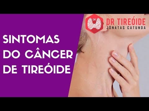 Sintomas do Câncer de Tireóide | Dr Jônatas Catunda