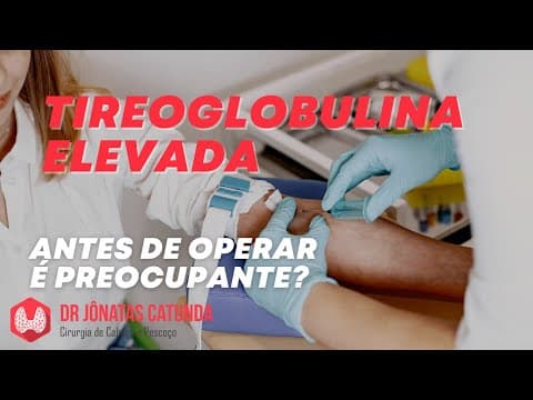 Tireoglobulina elevada antes de operar - câncer de tireoide