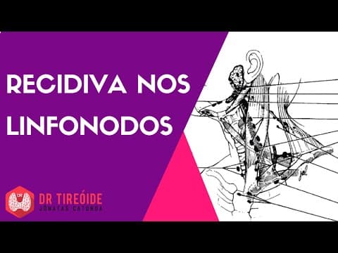 Recidiva nos linfonodos - Câncer de tireóide