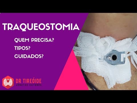 Tudo sobre Traqueostomia - Indicações, tipos, cuidados!