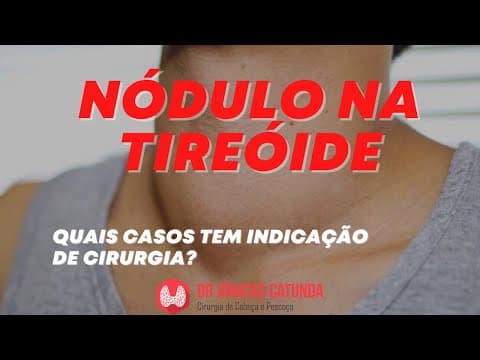 Nódulo na tireóide - Quais casos tem que operar?