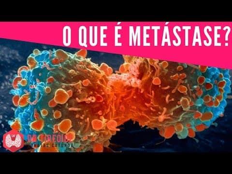 O que é metástase? | Dr Jônatas Catunda