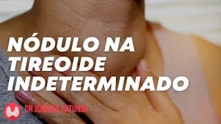 Nódulo na tireóide grande e indeterminado