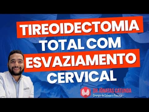 Tireoidectomia total com esvaziamento cervical - Câncer de tireoide