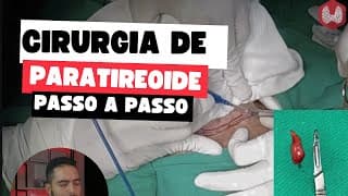 Cirurgia de paratireoide passo a passo: tratando o hiperparatireoidismo