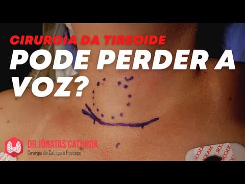 Tireoidectomia - pode perder a voz?