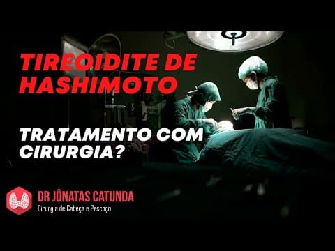 Tireoidite de Hashimoto: é possível tratar com cirurgia?
