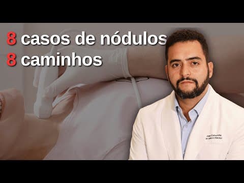 8 casos de nódulos na tireoide, 8 caminhos diferentes | LIVE comentando ultrassons reais
