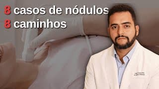 8 casos de nódulos na tireoide, 8 caminhos diferentes | LIVE comentando ultrassons reais