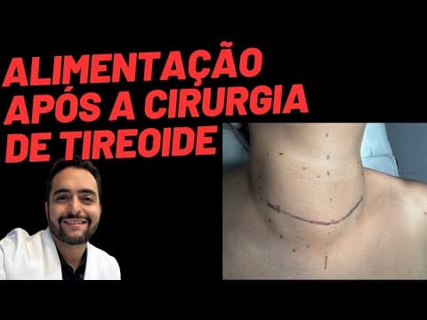 Alimentação após a cirurgia da tireoide: o que pode e o que evitar?