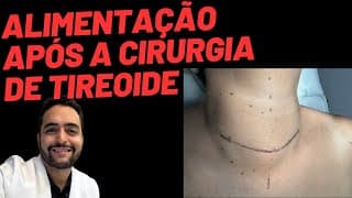 Alimentação após a cirurgia da tireoide: o que pode e o que evitar?