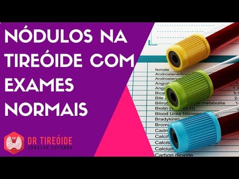 Nódulo na tireóide com exames normais | Dr Jônatas Catunda