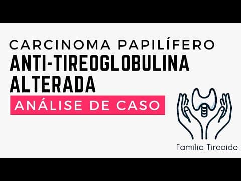 Anti-tireoglobulina alterada no seguimento do câncer - Analisando exames