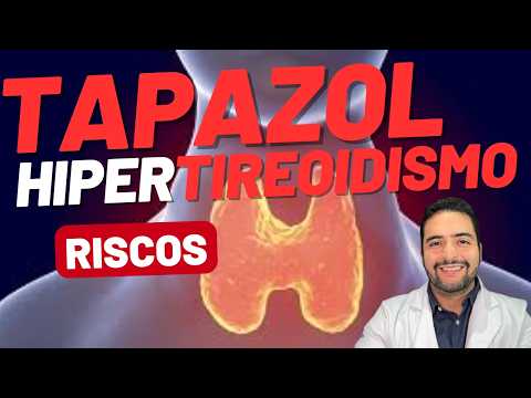 Tapazol (metimazol) é seguro? Efeitos colaterais