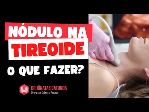Tratamento do nódulo na tireoide benigno e maligno