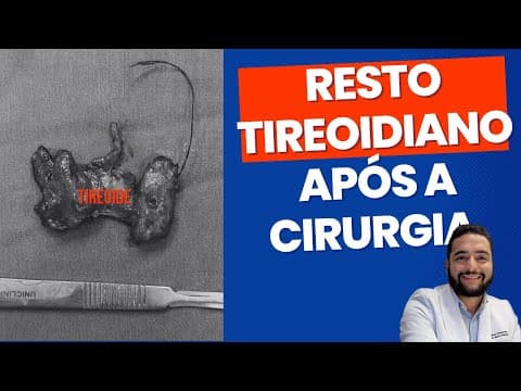Resto tireoidiano após a cirurgia - causa tireoglobulina elevada
