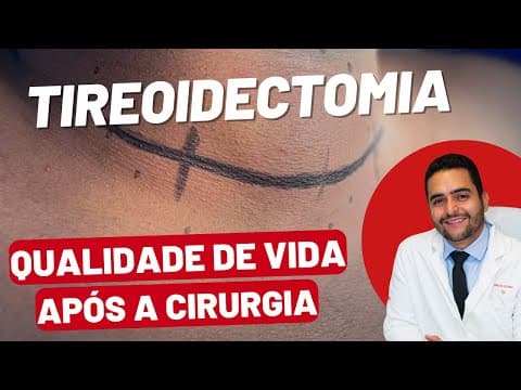 Tireoidectomia e Qualidade de Vida: O Que Você Precisa Saber