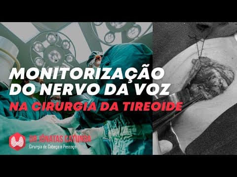 Monitorização do nervo da voz na tireoidectomia - evita rouquidão?