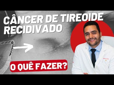 Câncer de Tireoide Recidivado: Opções de Tratamento e Acompanhamento