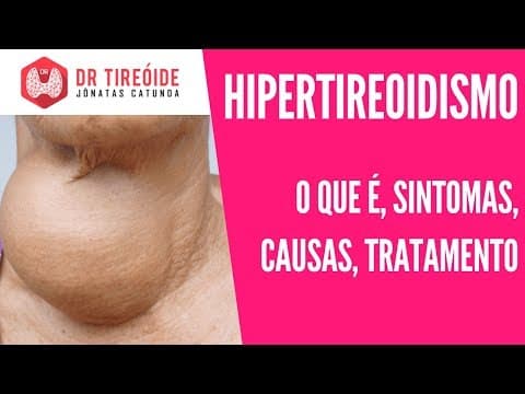 Hipertireoidismo - O que é? Sintomas ? Causas? Tratamento? | Dr Jônatas Catunda